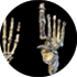 Homo naledi might have walked